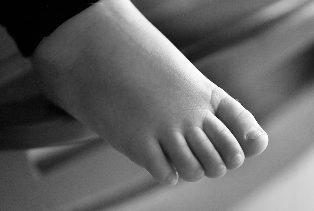 Zo ontstaat eelt op je voeten en wat je eraan kunt doen